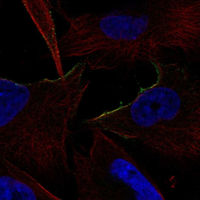 alpha-1b Adrenergic Receptor Antibody in Immunocytochemistry (ICC/IF)