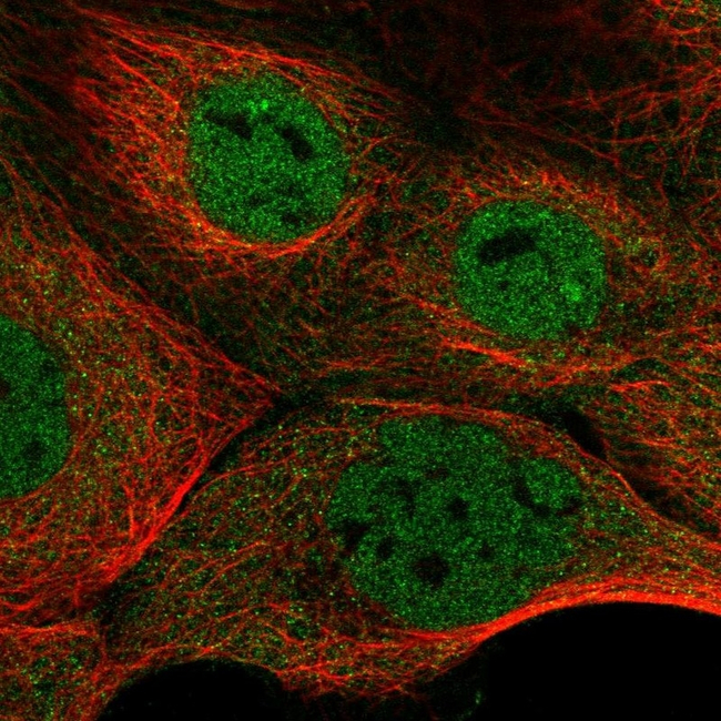 NFATC3 Antibody in Immunocytochemistry (ICC/IF)