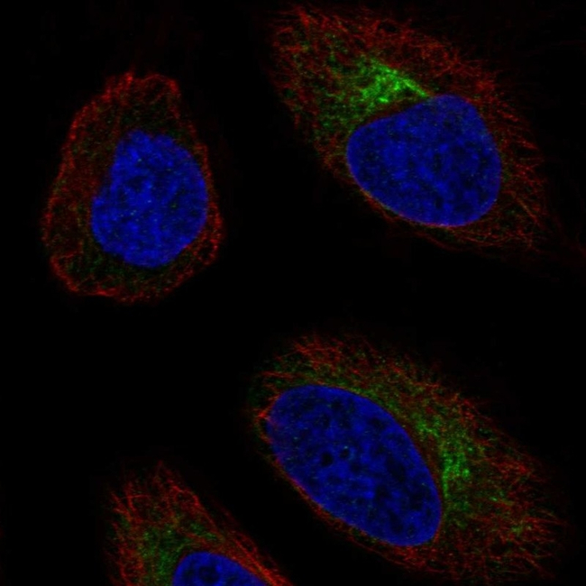 CCR10 Antibody in Immunocytochemistry (ICC/IF)