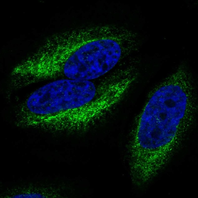 CCR10 Antibody in Immunocytochemistry (ICC/IF)