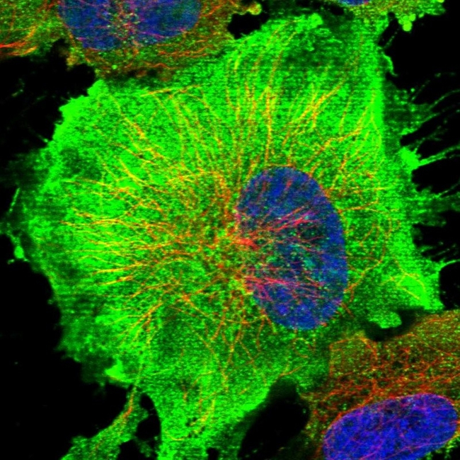 Complement C9 Antibody in Immunocytochemistry (ICC/IF)