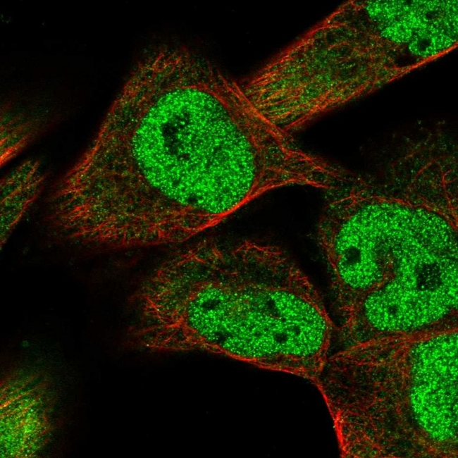 SMAD9 Antibody in Immunocytochemistry (ICC/IF)