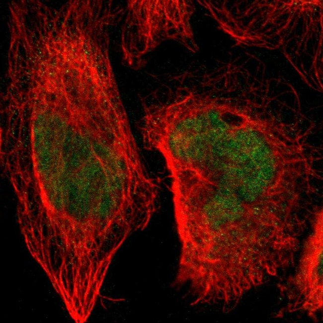 SENP1 Antibody in Immunocytochemistry (ICC/IF)
