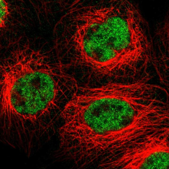 FZD10 Antibody in Immunocytochemistry (ICC/IF)