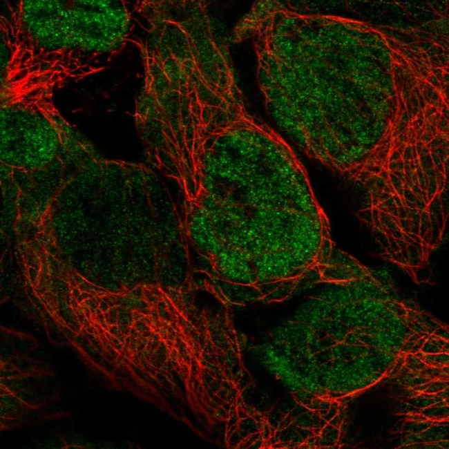 PSMD3 Antibody in Immunocytochemistry (ICC/IF)