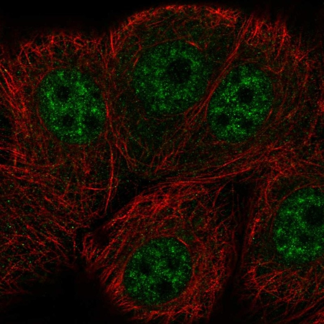 ERCC8 Antibody in Immunocytochemistry (ICC/IF)