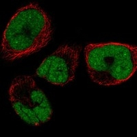 SMNDC1 Antibody in Immunocytochemistry (ICC/IF)