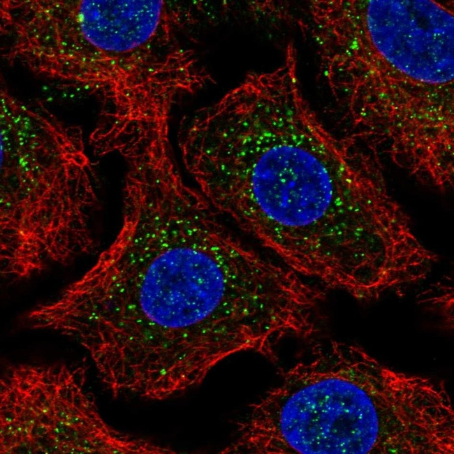 beta-Arrestin 2 Antibody in Immunocytochemistry (ICC/IF)