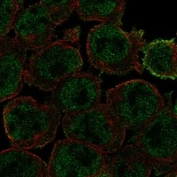 beta-Arrestin 2 Antibody in Immunocytochemistry (ICC/IF)