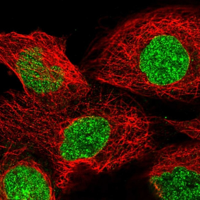 Tankyrase Antibody in Immunocytochemistry (ICC/IF)