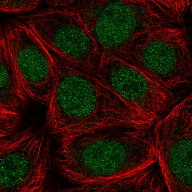 Cdc73 Antibody in Immunocytochemistry (ICC/IF)