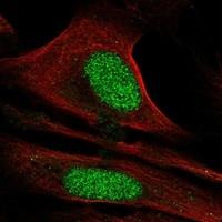 Cdc73 Antibody in Immunocytochemistry (ICC/IF)