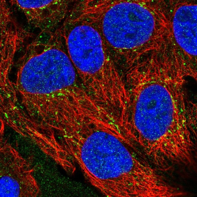 CXCL16 Antibody in Immunocytochemistry (ICC/IF)
