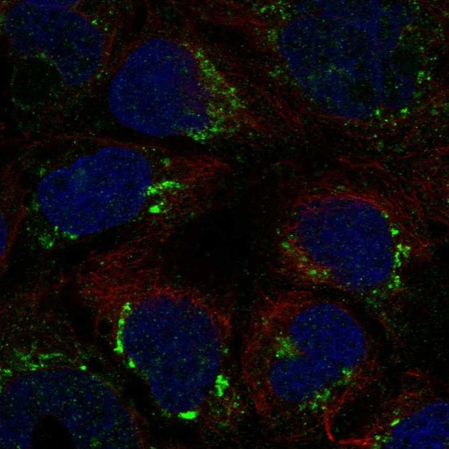 ATP7B Antibody in Immunocytochemistry (ICC/IF)