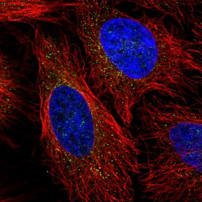 LPL Antibody in Immunocytochemistry (ICC/IF)
