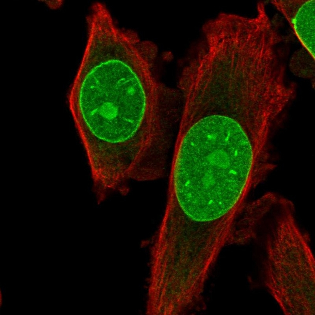 TRIB3 Antibody in Immunocytochemistry (ICC/IF)