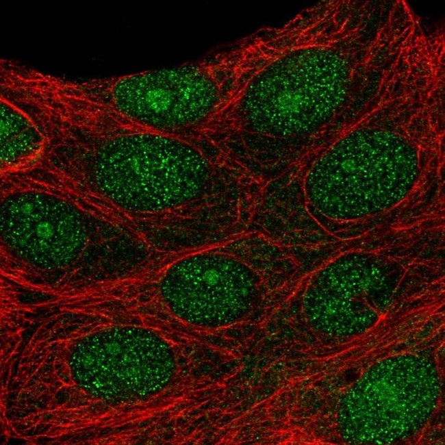 PRMT6 Antibody in Immunocytochemistry (ICC/IF)