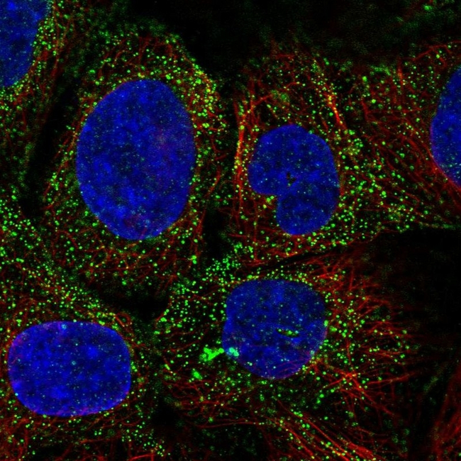 PDGF-D Antibody in Immunocytochemistry (ICC/IF)