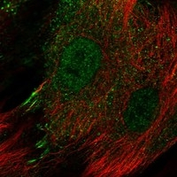 IL13RA2 Antibody in Immunocytochemistry (ICC/IF)