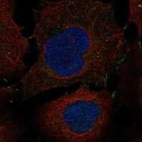 IL13RA2 Antibody in Immunocytochemistry (ICC/IF)