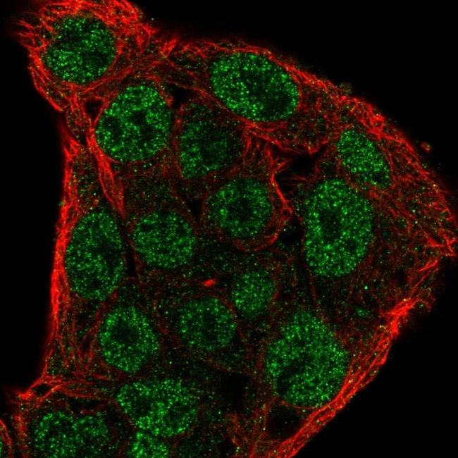 SOCS1 Antibody in Immunocytochemistry (ICC/IF)