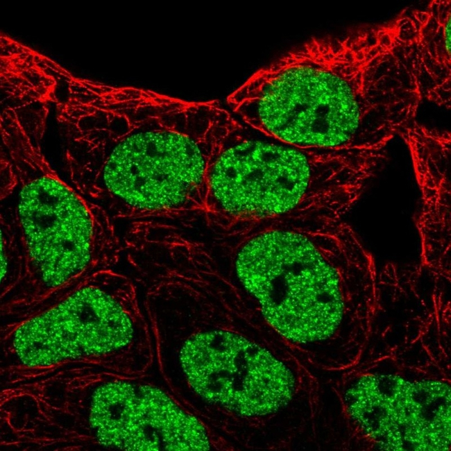 EphB6 Antibody in Immunocytochemistry (ICC/IF)