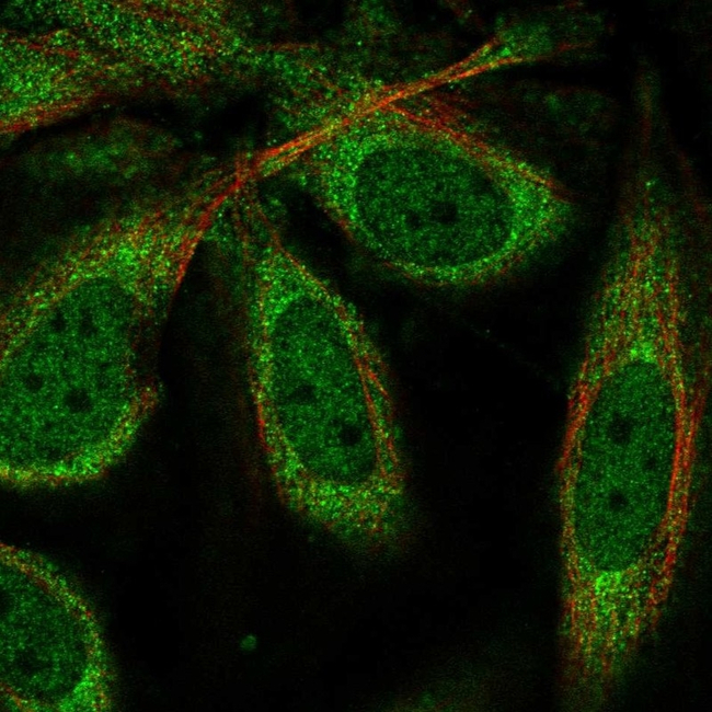CPEB1 Antibody in Immunocytochemistry (ICC/IF)