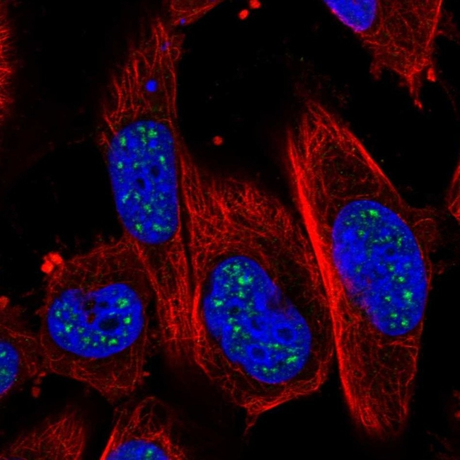 ADAMTS4 Antibody in Immunocytochemistry (ICC/IF)