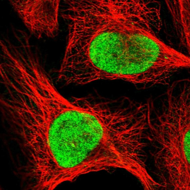 RFC1 Antibody in Immunocytochemistry (ICC/IF)