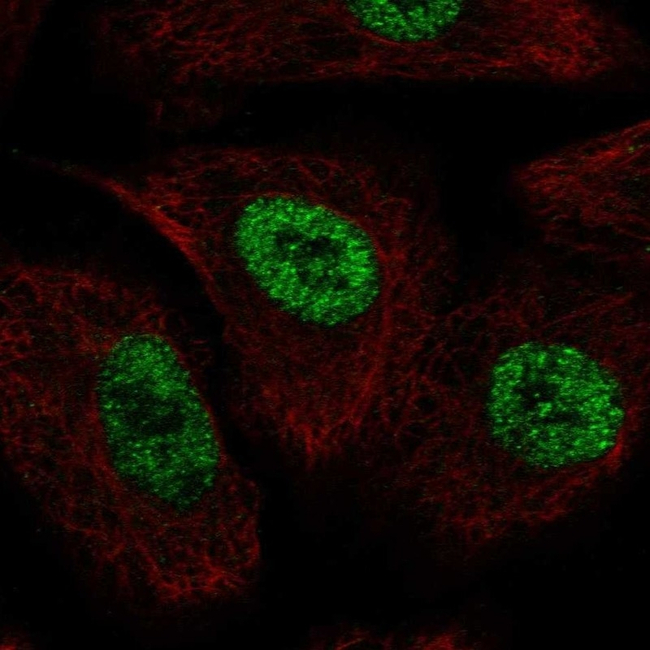 TLE1 Antibody in Immunocytochemistry (ICC/IF)