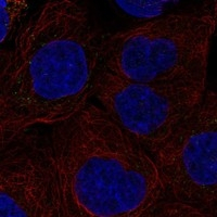 TCCR Antibody in Immunocytochemistry (ICC/IF)
