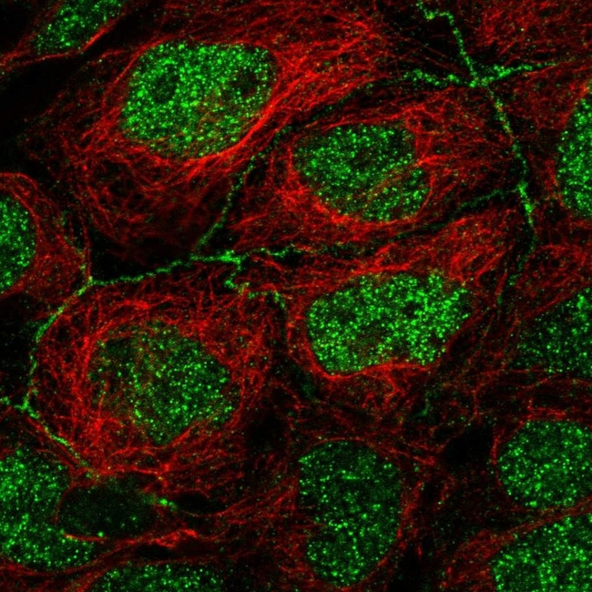 ApoC3 Antibody in Immunocytochemistry (ICC/IF)