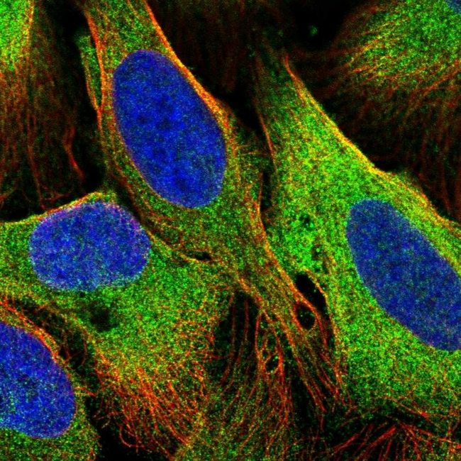 AS160 Antibody in Immunocytochemistry (ICC/IF)
