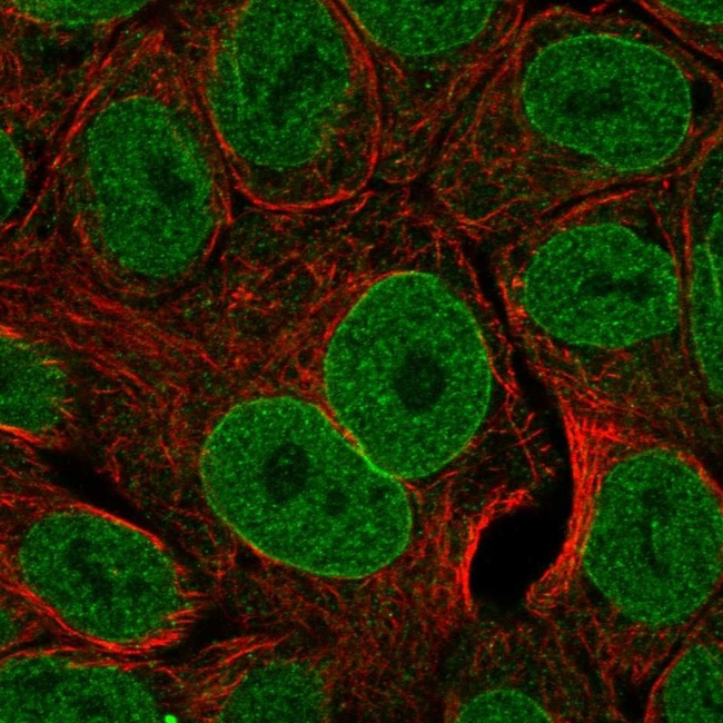 TL1A Antibody in Immunocytochemistry (ICC/IF)