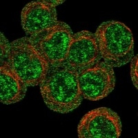 EpoR Antibody in Immunocytochemistry (ICC/IF)
