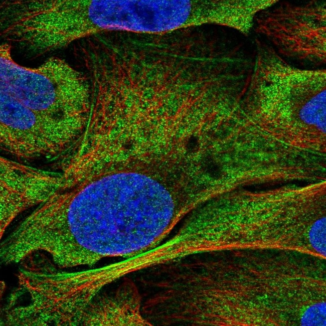 NOTCH3 Antibody in Immunocytochemistry (ICC/IF)