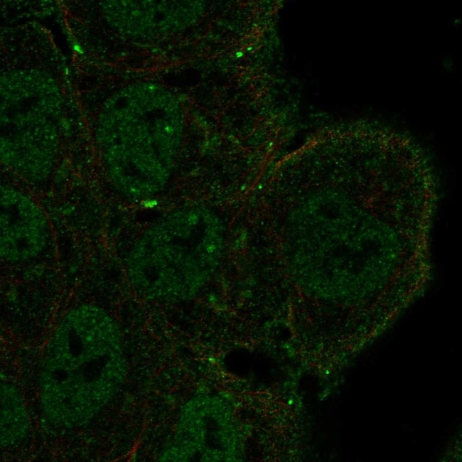 NOTCH3 Antibody in Immunocytochemistry (ICC/IF)