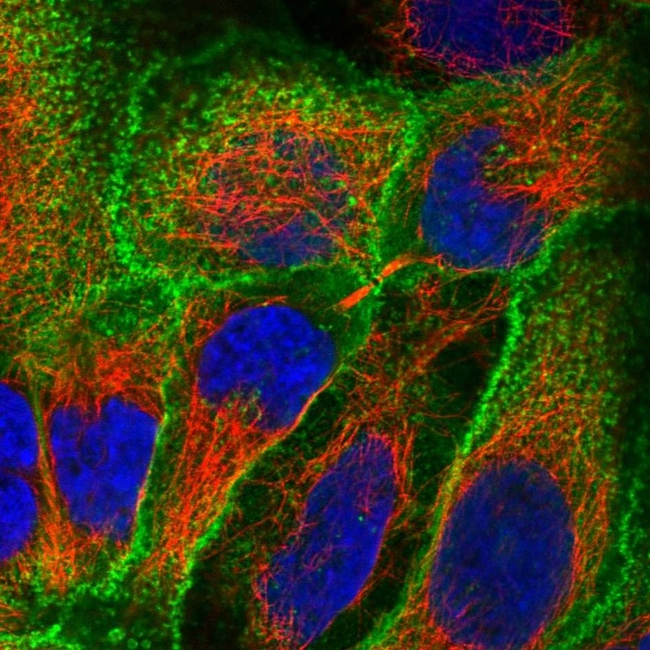 GLUT3 Antibody in Immunocytochemistry (ICC/IF)
