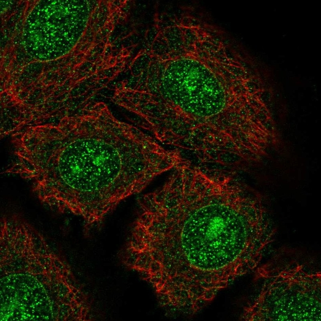 TrkC Antibody in Immunocytochemistry (ICC/IF)