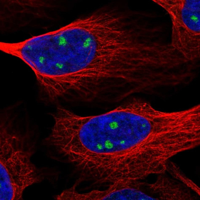 TrkC Antibody in Immunocytochemistry (ICC/IF)