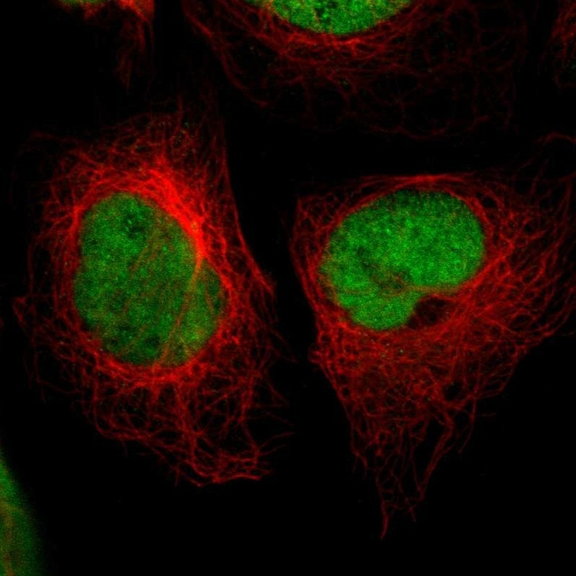 CREB Antibody in Immunocytochemistry (ICC/IF)