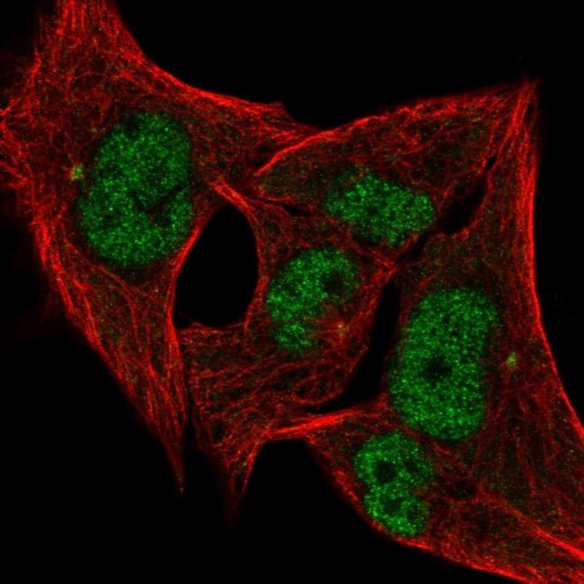 PHAP I Antibody in Immunocytochemistry (ICC/IF)