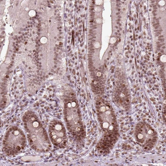 BRAF35 Antibody in Immunohistochemistry (Paraffin) (IHC (P))
