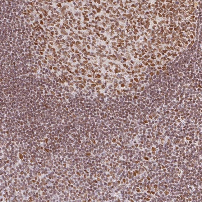 Histone H2A.Z Antibody in Immunohistochemistry (Paraffin) (IHC (P))