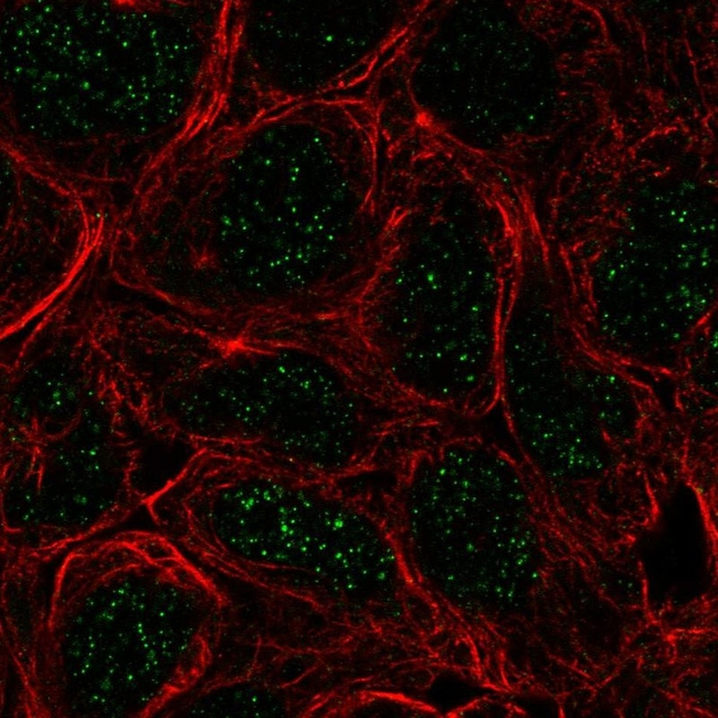 TBX6 Antibody in Immunocytochemistry (ICC/IF)