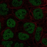 TBX3 Antibody in Immunocytochemistry (ICC/IF)