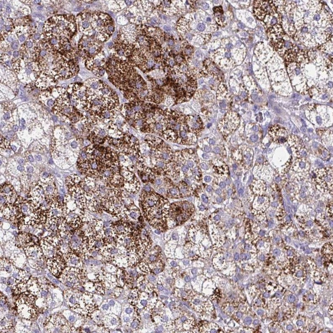 SREBP1 Antibody in Immunohistochemistry (Paraffin) (IHC (P))
