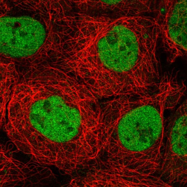 MBD2 Antibody in Immunocytochemistry (ICC/IF)