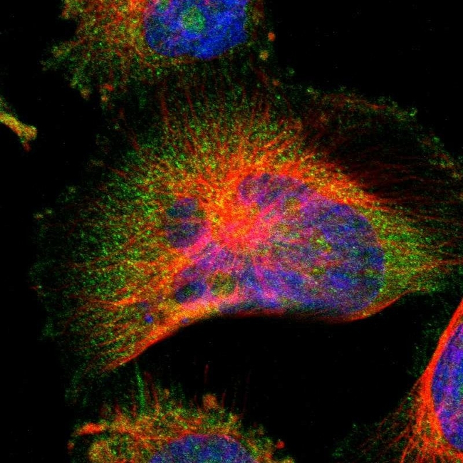 SIRT2 Antibody in Immunocytochemistry (ICC/IF)