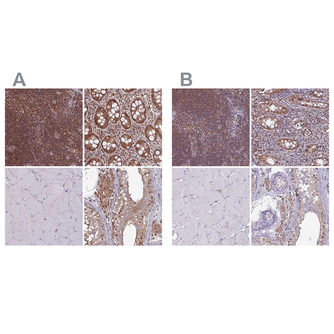 PSMB8 Antibody in Immunohistochemistry (Paraffin) (IHC (P))